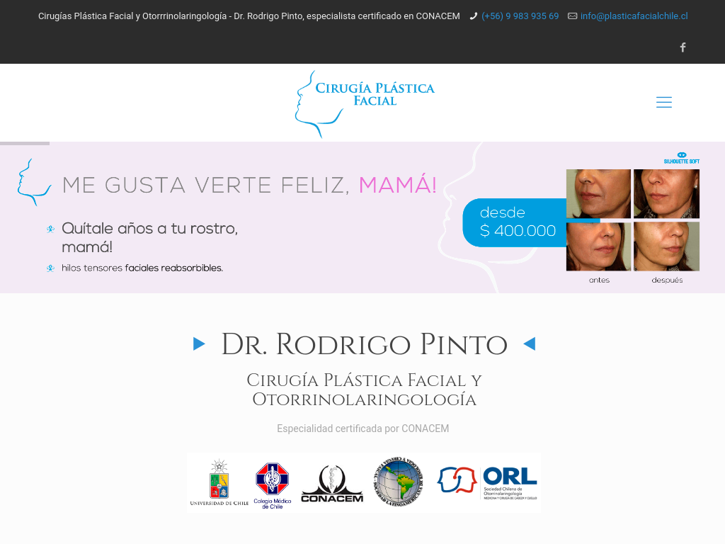 Rinoplastia en Chile